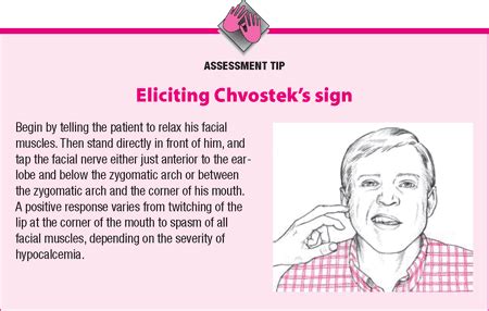 Doctors Gates Eliciting Chvosteks Sign