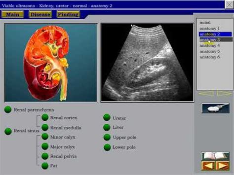 Normal Kidney Ultrasound