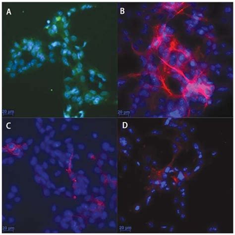 Characterization Of Neural Progenitor Cells Npcs By Download Scientific Diagram