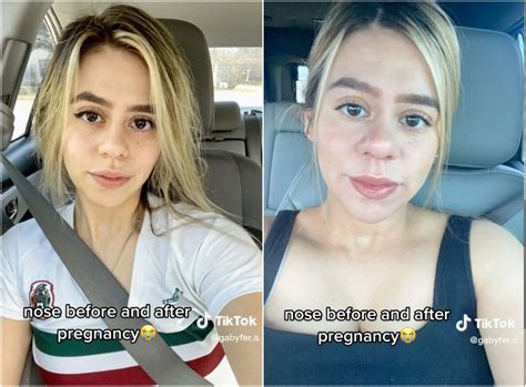 Early Pregnancy Swollen Lips And Nose - Infoupdate.org