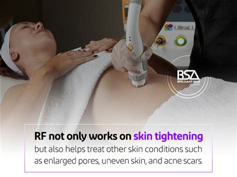 Radio Frequency Skin Tightening Dangers