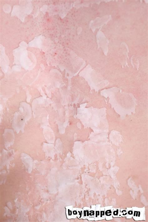 Tied And Uncomfortable Liam King Is Subjected To A Long And Painful Session Of Red Hot Wax Over