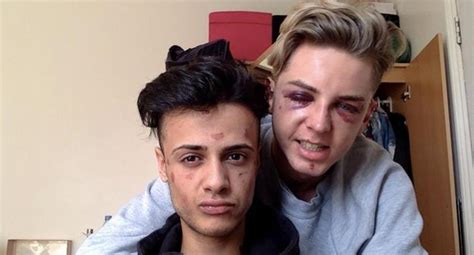 El dramático relato de parejas gay que fueron brutalmente atacadas BBC MUNDO EL COMERCIO PERÚ