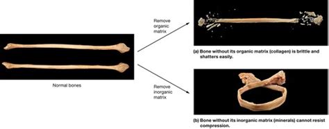 The Extracellular Matrix of Bone Flashcards | Quizlet