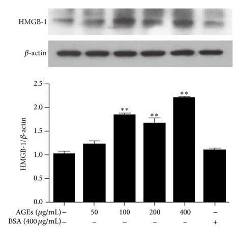 Expression Of HMGB 1 In Late EPCs And Cell Supernatants Induced By AGEs