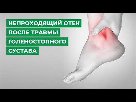 Опух голеностопный сустав с внешней и внутренней стороны и болит ...
