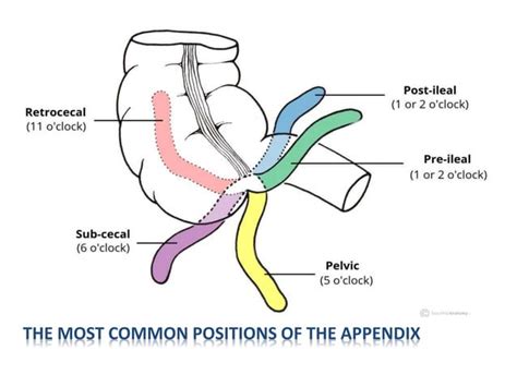 Appendix Colon Rectums Ana Anal Canal Presentation Powerpoint Pptx