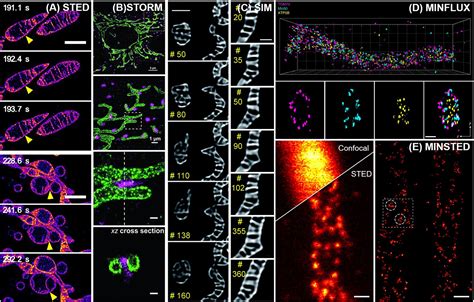 Unleashing The Potential Super Resolution Microscopy As The Key To