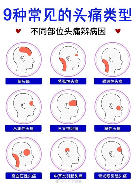 9种不同部位的头痛原因缓解头疼的十个小妙招建议收藏起来