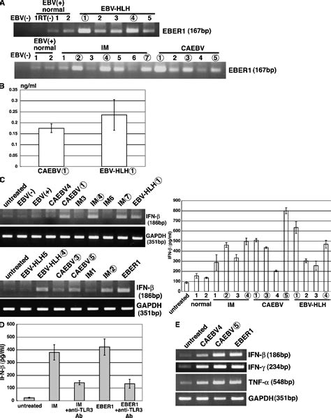 Figure 1 From Epstein Barr Virus EBV Encoded Small RNA Is Released