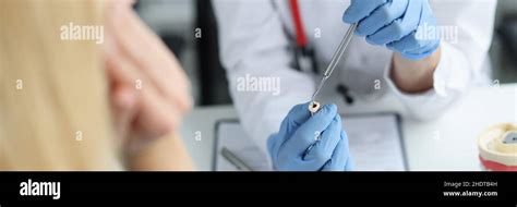 Doctor dentist shows patient with toothache tooth with hole inside and ...