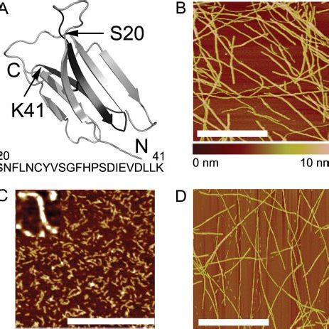 Distinct Conformational States Of 2 M A Structure Of Native 2 M And