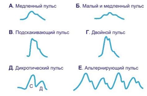 Виды пульса