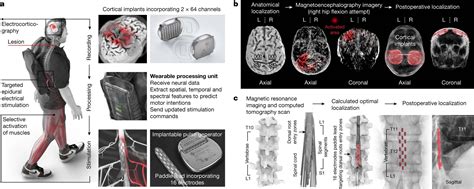 Une Interface Exp Rimentale Cerveau Colonne Vert Brale Aide Un Homme