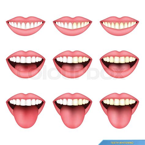 set of mouth and teeth, tooth whitening | Stock vector | Colourbox