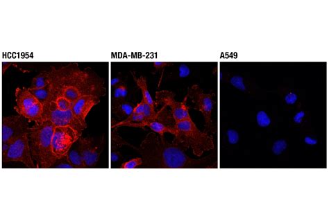 PD-L1 (Extracellular Domain Specific) (D8T4X) Rabbit mAb (Alexa Fluor ...