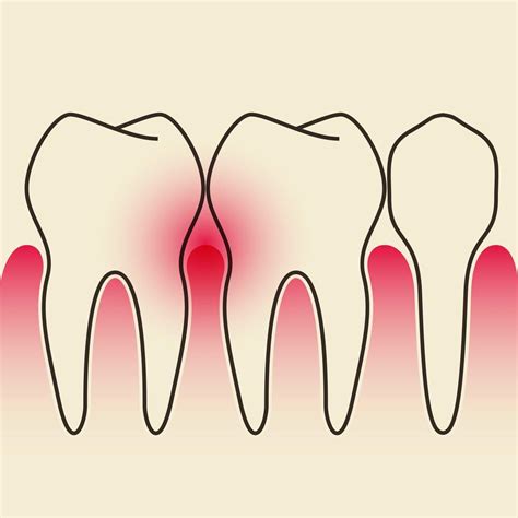 Does The Color Of Your Gums Mean Anything Mora Hare
