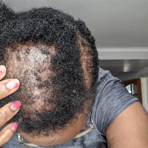 Grow your hair too – H.H Cosmetics