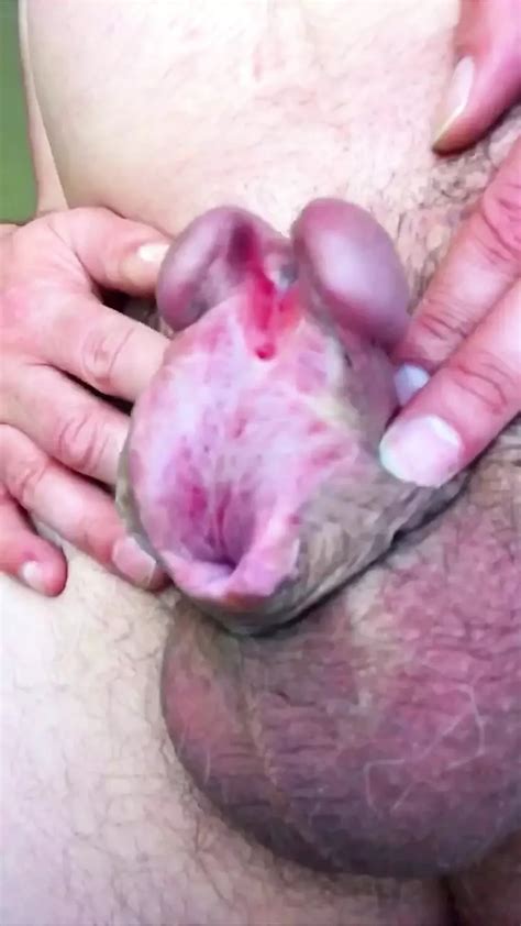 Micropenis Porn Videos Gay XXX XHamster