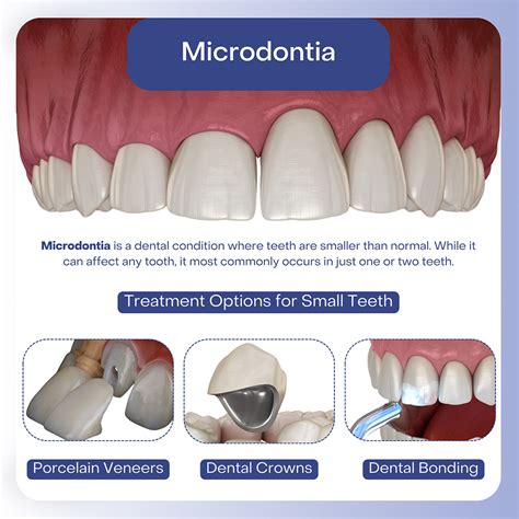 Small Teeth Treatment in Hackensack, Bergen County, NJ