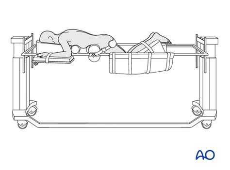 Prone Position