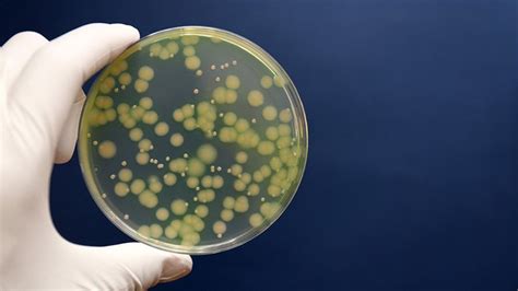 bacterial infections  symptoms tpyes treatment