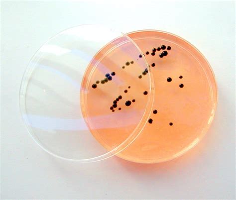 Proteus mirabilis antibiotic susceptibility