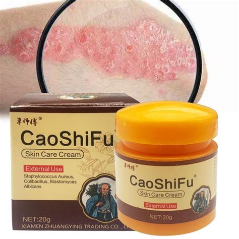 Caoshifu Антибактериальный крем для кожи, мазь от псориаза, дерматита ...