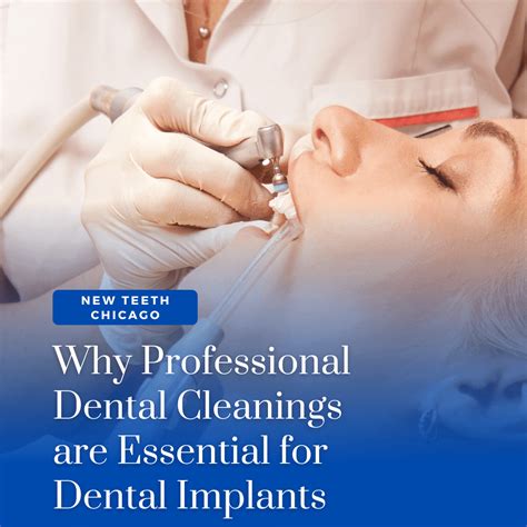 Why Professional Dental Cleanings Are Essential For Dental Implants