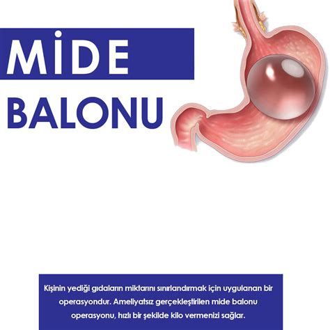 Mide Balonu Omc Klinik Obezite Cerrahisi