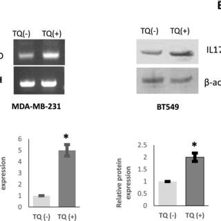 Effect Of TQ On TNBC Cell Viability TQ Shows Dose Dependent Growth