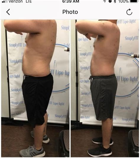 Lipotropic Injections For Weight Loss Reviews Blog Dandk