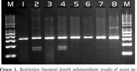 Figure From Matrix Metalloproteinase Promoter Gene Polymorphism