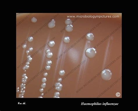 Haemophilus influenzae colonies. H.influenzae colonies close-up. Colony ...