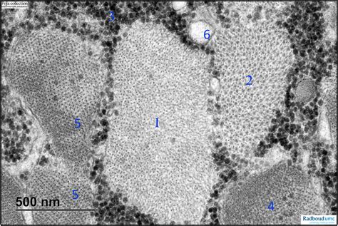 Electron Micrograph Of A Cross Sectioned Sarcomere Of Skeletal Muscle