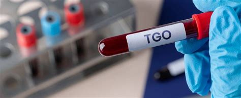 Exame Tgo E Tgp Para Que Serve - Exame de Ultrassonografia Região Inguinal | +Clinic
