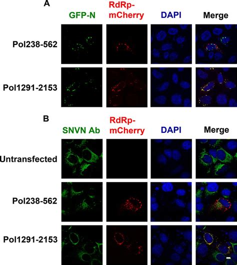 Interaction Between Hantavirus Nucleocapsid Protein N And RNA