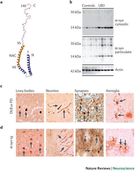 Biochemical structure of α synuclein and its pathological distribution