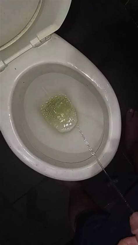 Peeing In The Toilet With Catheter In Penis Gay Asian Porn Feat Lildiaperboy XHamster