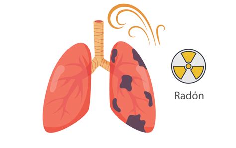 El Rad N En M Xico Un Riesgo Radiactivo De La Naturaleza Grupo