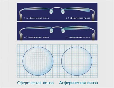 Линзы сферического и асферического дизайна. в чем разница?