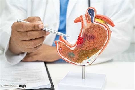 Fisura Anal Causas S Ntomas Y Tratamientos Efectivos Click Aqu