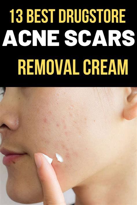 How To Get Rid Of Pitted Acne Scars Shearlingwomenbestquality