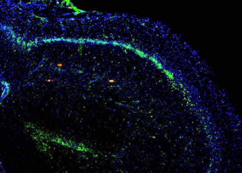 Insights into the Circuits that Make Memories | Kavli Foundation