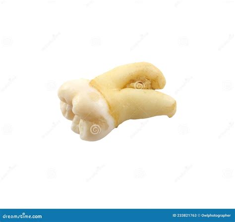 how to care for exposed tooth 10