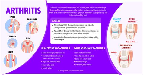 Arthritis and Its Natural Management - Nutroga
