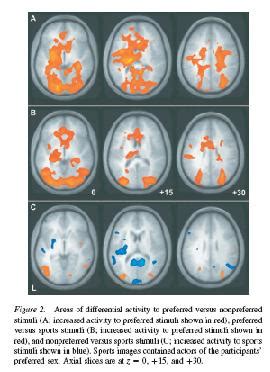 Neuroimaging Study Differentiates Gay And Straight Males Warren Throckmorton