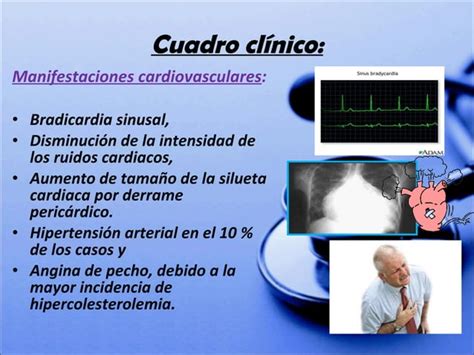 Hipertiroidismo E Hipotiroidismo Ppt