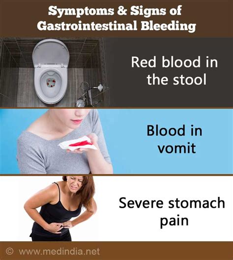 Gastrointestinal Bleeding Gi Bleed Causes Symptoms And Signs