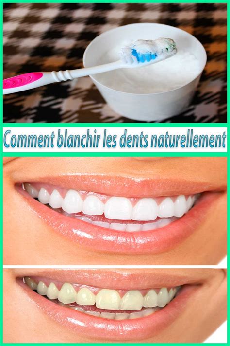 Comment blanchir les dents naturellement Remèdes Maison